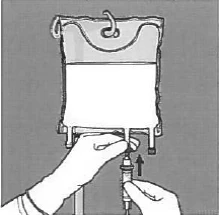 Hands connecting a syringe to an infusion system by inserting it into the port of a solution bag for intravenous administration