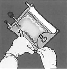 Gloved hands opening a package containing a medical device, removing it from a sterile sealed pouch for aseptic use