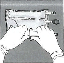 Hands holding a medical device with two tubes and clamps, positioned on a surface, featuring a ring on one of the tubes