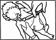 Un bambino giace supino, mentre un adulto inserisce una siringa nella parte superiore della coscia del bambino, tenendo fermo il piede per stabilizzazione