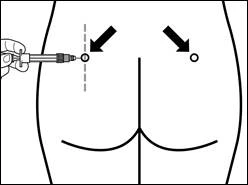 Hand injecting a syringe into the upper-outer part of the buttock, with arrows indicating the correct injection site