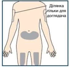 Схема тіла людини з виділеними ділянками для ін'єкцій: плече, живіт, стегна, з позначкою що ділянка тільки для доглядача