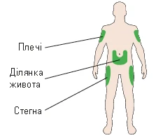 Схема тела человека с обозначенными зонами для инъекций