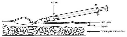 Una jeringa inyecta 0,1 ml de solución bajo la piel, indicando las capas de la piel: epidermis, dermis y tejido celular subcutáneo