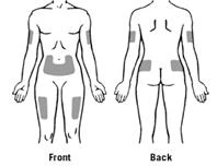 Diagram of the body showing marked areas for injection