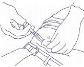 Mano sosteniendo una jeringa en un ángulo de 45 grados, introduciendo la aguja en el tejido muscular del brazo, la otra mano fija la piel alrededor del lugar de la inyección