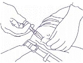 Una mano sostiene una jeringa insertando la aguja bajo la piel en la zona abdominal, mientras la otra mano mantiene la piel tensa para la inyección
